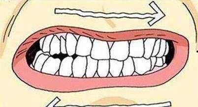 成人修磨牙视频,专业视频带你直观了解-第1张图片-九色视频在线观看 成人修磨牙视频,专业视频带你直观了解-第1张图片-九色视频在线观看