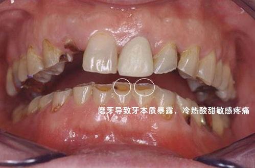 成人修磨牙视频,专业视频带你直观了解-第3张图片-九色视频在线观看 成人修磨牙视频,专业视频带你直观了解-第3张图片-九色视频在线观看