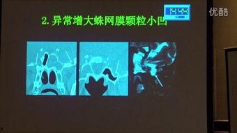 成人性结合视频播放,情感与生理的交织-第3张图片-九色视频在线观看